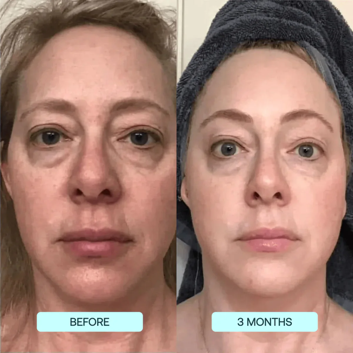 NANO SKIN™ FACE REJUVENATION ANTI AGING FORMULA COLLAGEN FILMS - Image 3
