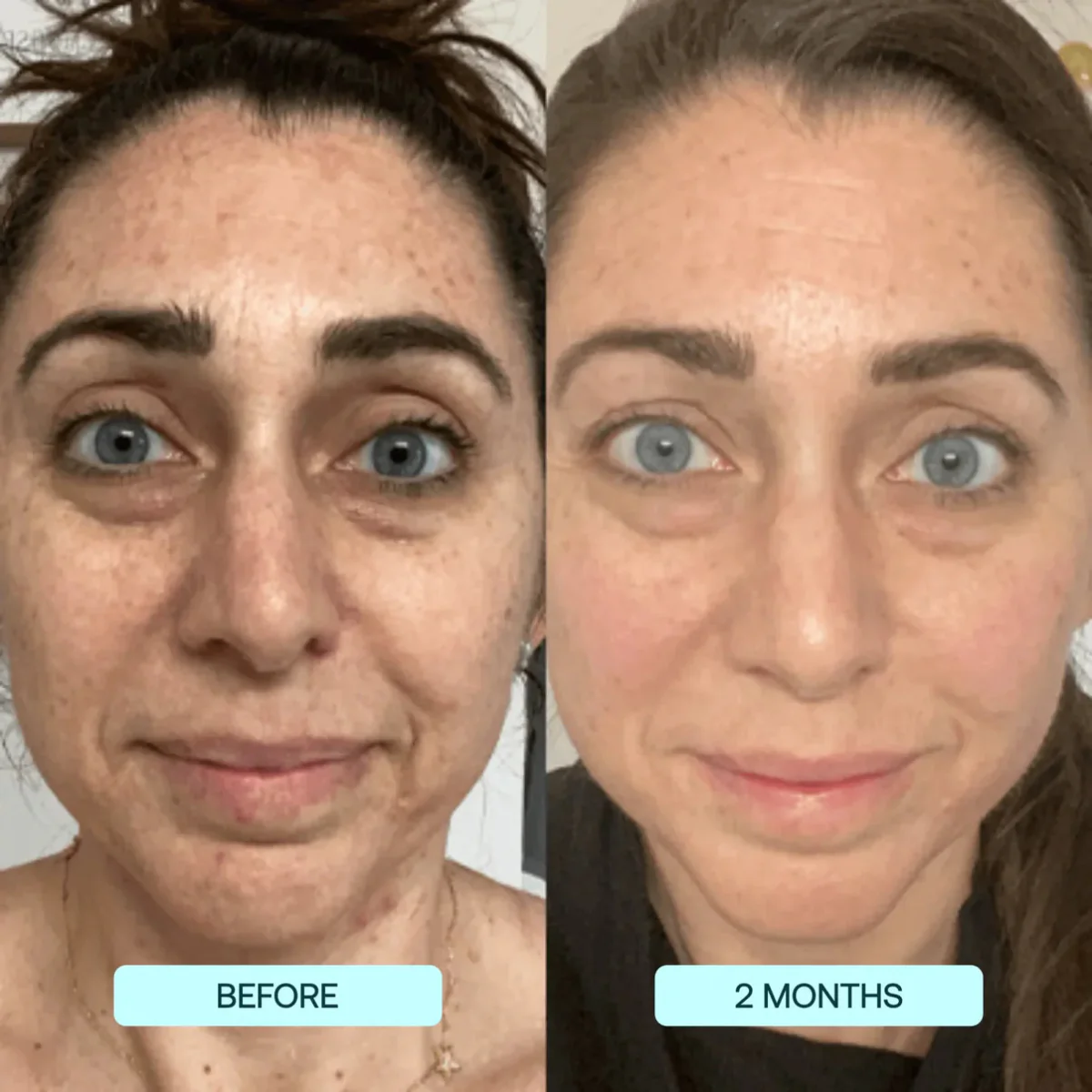 NANO SKIN™ FACE REJUVENATION ANTI AGING FORMULA COLLAGEN FILMS - Image 4