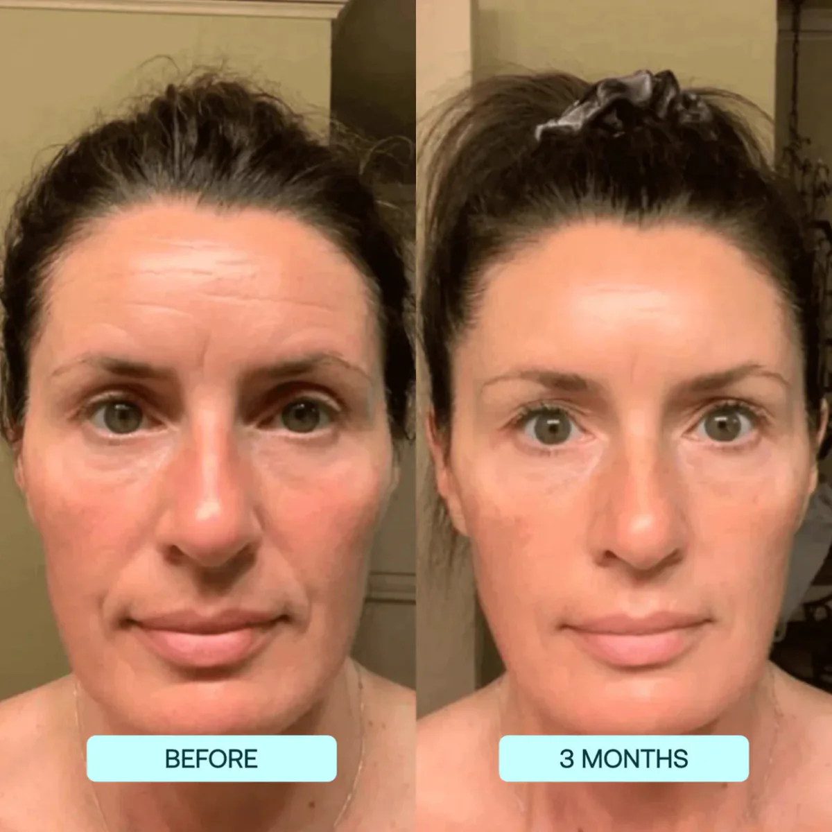 NANO SKIN™ FACE REJUVENATION ANTI AGING FORMULA COLLAGEN FILMS - Image 5