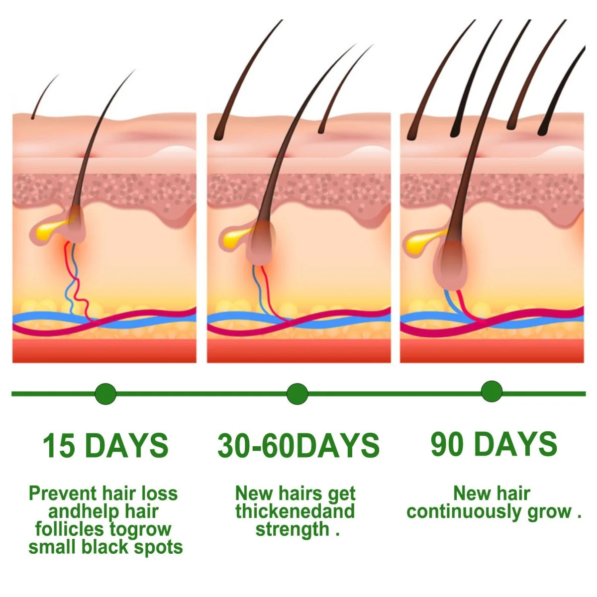 Rosemary Anti-Breakage Nourishing Hair Care Oil (One Free with Therapy Brush) - Image 3